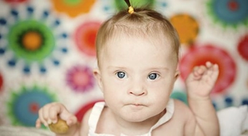 Down Sendromu Nasıl Anlaşılır?