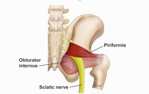 Piriformis Sendromu